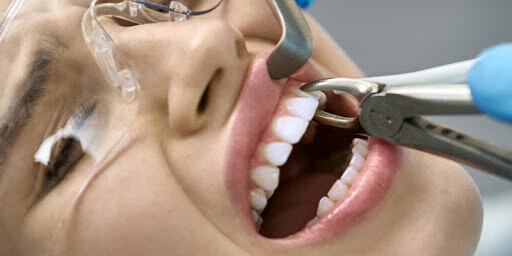 جراحی و كشيدن دندان چگونه است